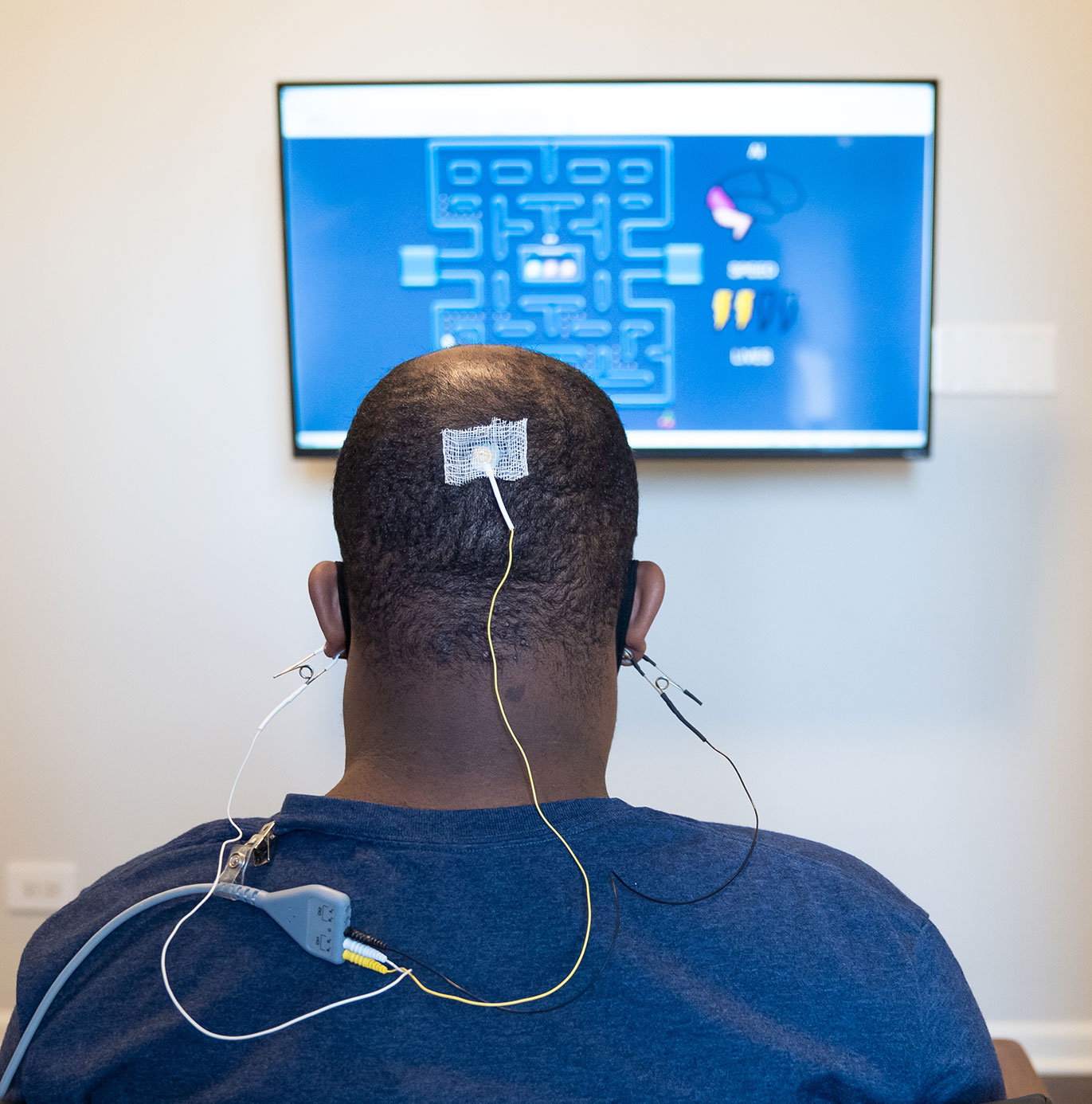 Neurofeedback Therapy | Synapse Chicago