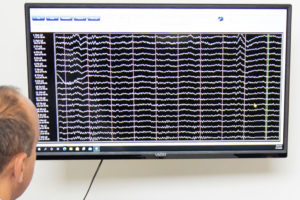 Brain Mapping/QEEG | Synapse Chicago